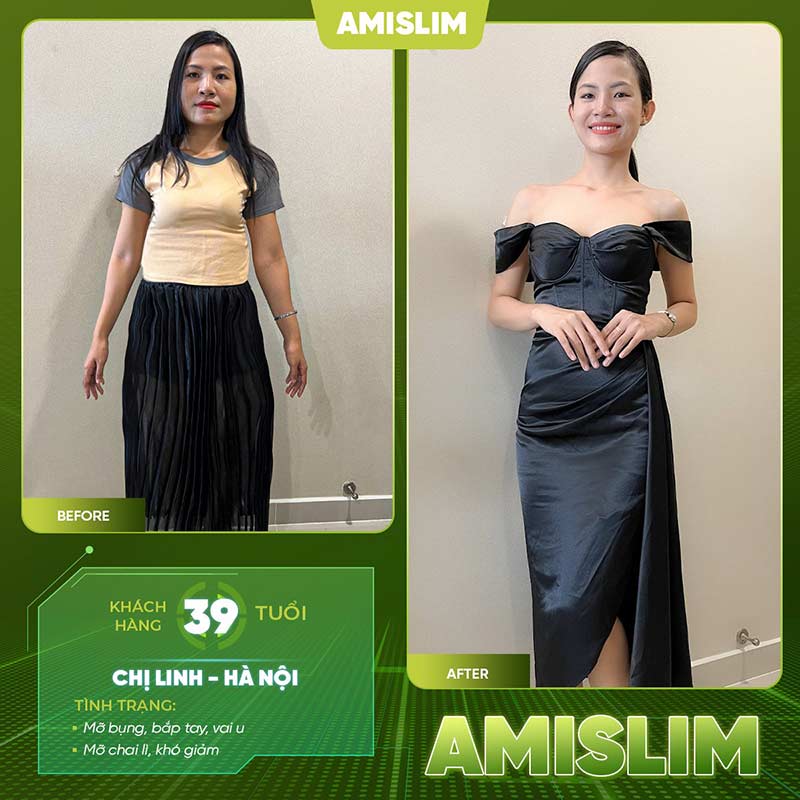 Bộ giải pháp giảm béo cao cấp Ami Slim giúp chị em tự tin lấy lại thân hình thời son rỗi